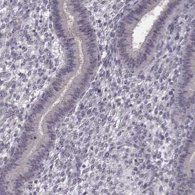 Immunohistochemistry-Paraffin: C10orf62 Antibody [NBP2-57437]