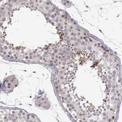 Immunohistochemistry-Paraffin: C10orf62 Antibody [NBP2-57437]