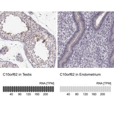 Immunohistochemistry-Paraffin: C10orf62 Antibody [NBP2-57437]