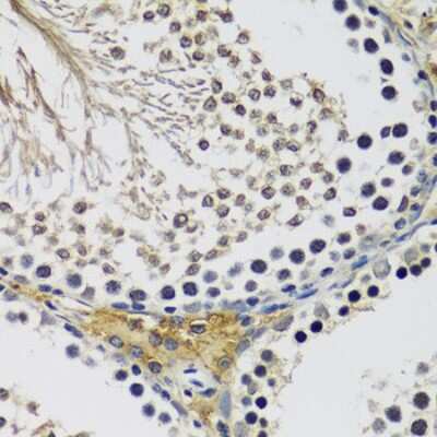 Immunohistochemistry-Paraffin: C10orf62 Antibody - BSA Free [NBP3-04546]