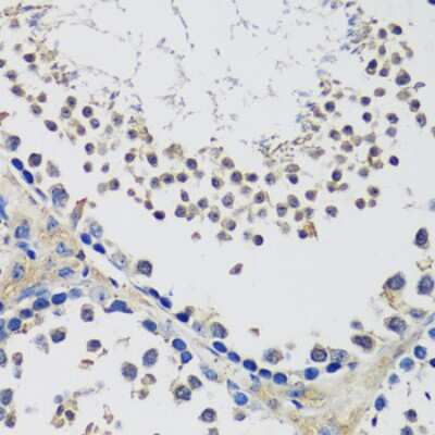 Immunohistochemistry-Paraffin: C10orf62 Antibody - BSA Free [NBP3-04546]