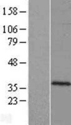 Western Blot: C10orf62 Overexpression Lysate [NBP2-08757]