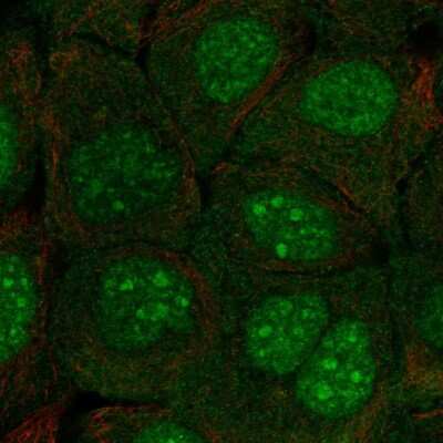 Immunocytochemistry/ Immunofluorescence: C10orf67 Antibody [NBP2-55273]