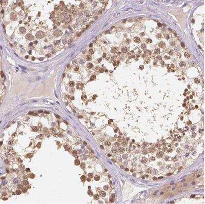 Immunohistochemistry-Paraffin: C10orf67 Antibody [NBP1-81068]