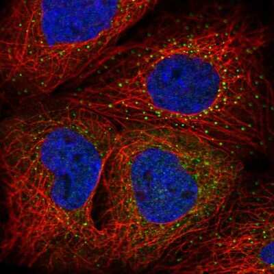 Immunocytochemistry/ Immunofluorescence: ARMH3 Antibody [NBP2-30723]