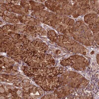 Immunohistochemistry-Paraffin: ARMH3 Antibody [NBP2-30398]