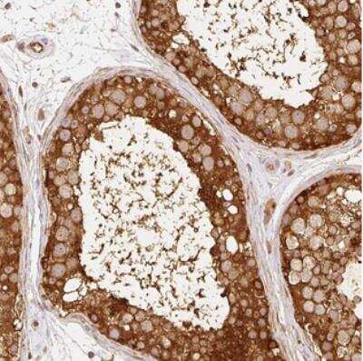 Immunohistochemistry: ARMH3 Antibody [NBP2-30723]