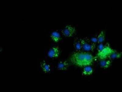 Immunocytochemistry/ Immunofluorescence: C10orf82 Antibody (OTI1G4) - Azide and BSA Free [NBP2-72401]