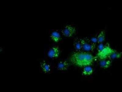 Immunocytochemistry/ Immunofluorescence: C10orf82 Antibody (OTI1G4) [NBP2-02828]