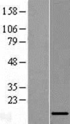 Western Blot: LINC01561 Overexpression Lysate [NBL1-08089]