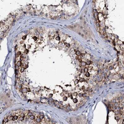 Immunohistochemistry-Paraffin: C10orf88 Antibody [NBP1-83978]