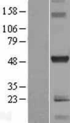 Western Blot: C10orf88 Overexpression Lysate [NBL1-08090]