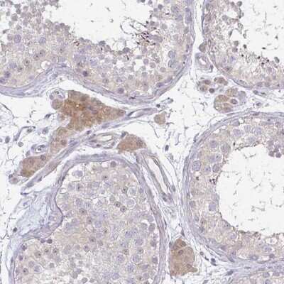 Immunohistochemistry: C10orf90 Antibody [NBP2-38830]