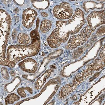 Immunohistochemistry-Paraffin: C10orf90 Antibody [NBP1-90793]