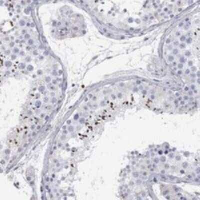 Immunohistochemistry-Paraffin: C10orf90 Antibody [NBP3-17348]