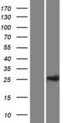 Western Blot: C10orf95 Overexpression Lysate [NBP2-06266]