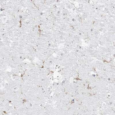Immunohistochemistry-Paraffin: C11orf1 Antibody [NBP1-82071]
