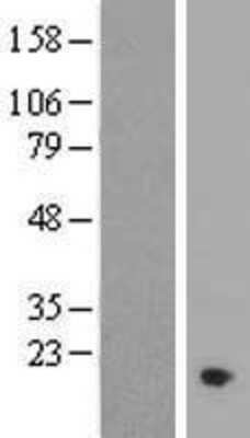 Western Blot: C11orf1 Overexpression Lysate [NBL1-08093]