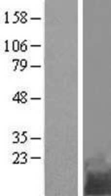 Western Blot: TMEM258 Overexpression Lysate [NBL1-08094]