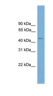 Western Blot: C11orf16 Antibody [NBP1-91488]