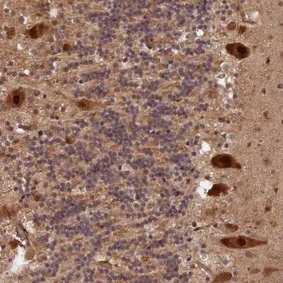 Immunohistochemistry-Paraffin: VPS51 Antibody [NBP1-90857]