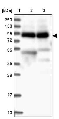 Western Blot: VPS51 Antibody [NBP1-90857]