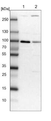 Western Blot: VPS51 Antibody [NBP1-90857]