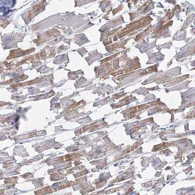 Immunohistochemistry-Paraffin: C11orf21 Antibody [NBP1-90995]