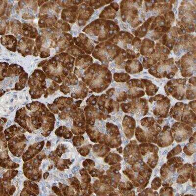 Immunohistochemistry-Paraffin: C11orf24 Antibody [NBP1-90493]