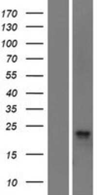 Western Blot: C11orf24 Overexpression Lysate [NBP2-06447]