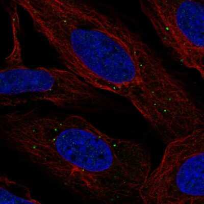 Immunocytochemistry/ Immunofluorescence: LMNTD2 Antibody [NBP2-56567]