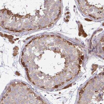 Immunohistochemistry-Paraffin: LMNTD2 Antibody [NBP2-31720]