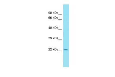 Western Blot: C11orf40 Antibody [NBP3-09648]