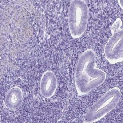 Immunohistochemistry-Paraffin: C11orf42 Antibody [NBP2-38028]