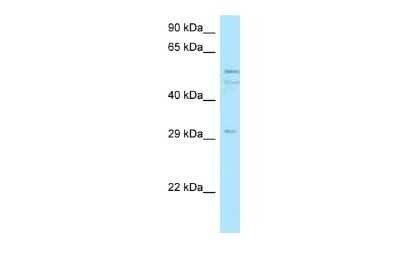 Western Blot: C11orf42 Antibody [NBP2-82815]