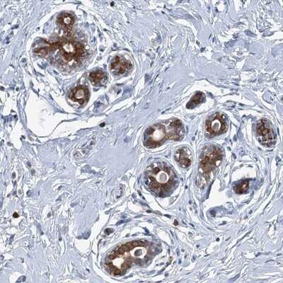 Immunohistochemistry-Paraffin: C11orf45 Antibody [NBP1-81900]