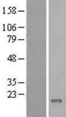 Western Blot: C11orf45 Overexpression Lysate [NBL1-08101]