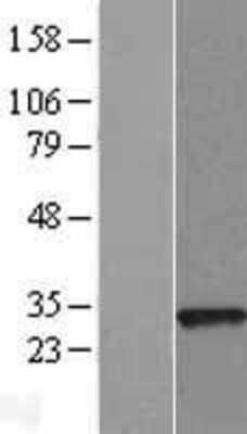 Western Blot: ARL14EP Overexpression Lysate [NBL1-08102]