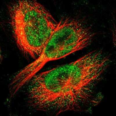 Immunocytochemistry/ Immunofluorescence: LBHD1 Antibody [NBP1-81156]