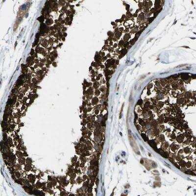 Immunohistochemistry-Paraffin: LBHD1 Antibody [NBP1-81156]