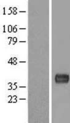 Western Blot: LBHD1 Overexpression Lysate [NBL1-08103]