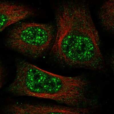 Immunocytochemistry/ Immunofluorescence: C11orf49 Antibody [NBP1-82127]