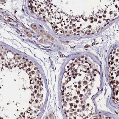 Immunohistochemistry-Paraffin: C11orf49 Antibody [NBP1-82127]