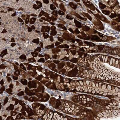 Immunohistochemistry-Paraffin: C11orf49 Antibody [NBP1-82128]
