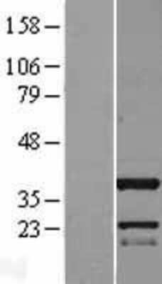 Western Blot: C11orf49 Overexpression Lysate [NBL1-08106]