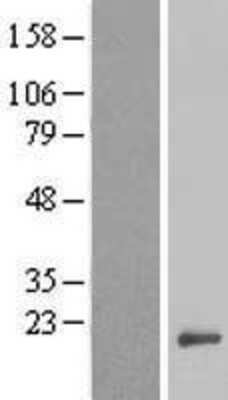 Western Blot: ANAPC15 Overexpression Lysate [NBL1-08107]