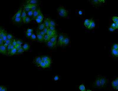 Immunocytochemistry/ Immunofluorescence: C11orf52 Antibody [NBP3-12547]