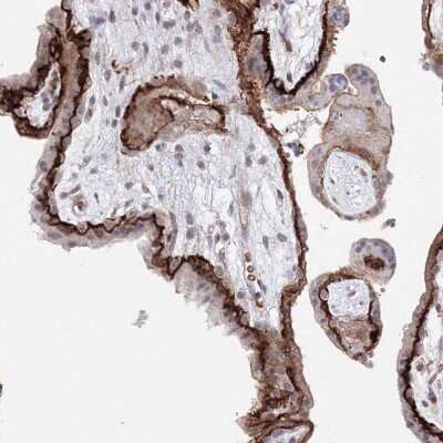 Immunohistochemistry-Paraffin: C11orf52 Antibody [NBP1-82060]