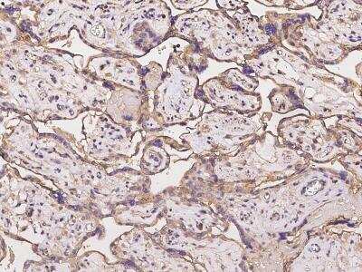 Immunohistochemistry-Paraffin: C11orf52 Antibody [NBP2-97392]