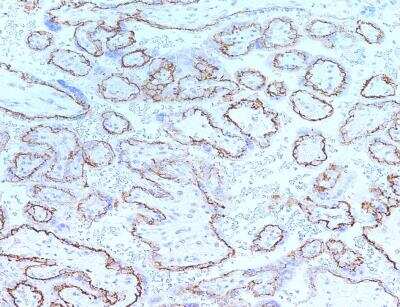 Immunohistochemistry-Paraffin: C11orf52 Antibody [NBP3-12547]